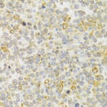 Immunohistochemistry - Anti-GPR54 Antibody (A11590) - Antibodies.com