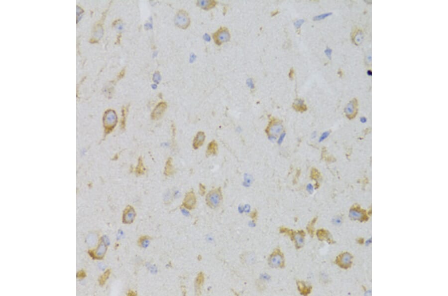 Immunohistochemistry - Anti-GPR54 Antibody (A11590) - Antibodies.com