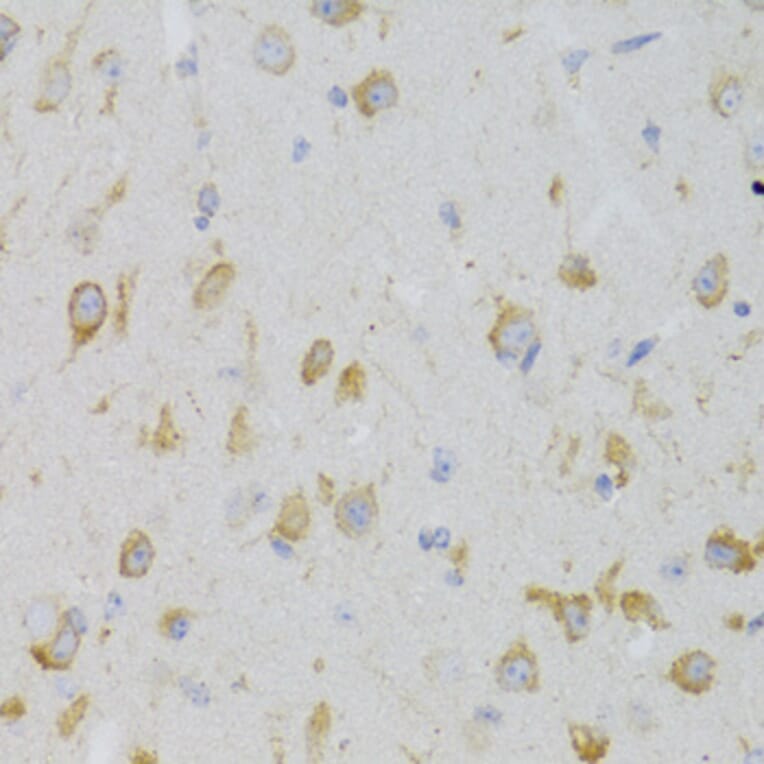 Immunohistochemistry - Anti-GPR54 Antibody (A11590) - Antibodies.com