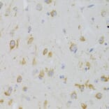 Immunohistochemistry - Anti-GPR54 Antibody (A11590) - Antibodies.com