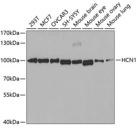Western Blot - Anti-HCN1 Antibody (A11591) - Antibodies.com