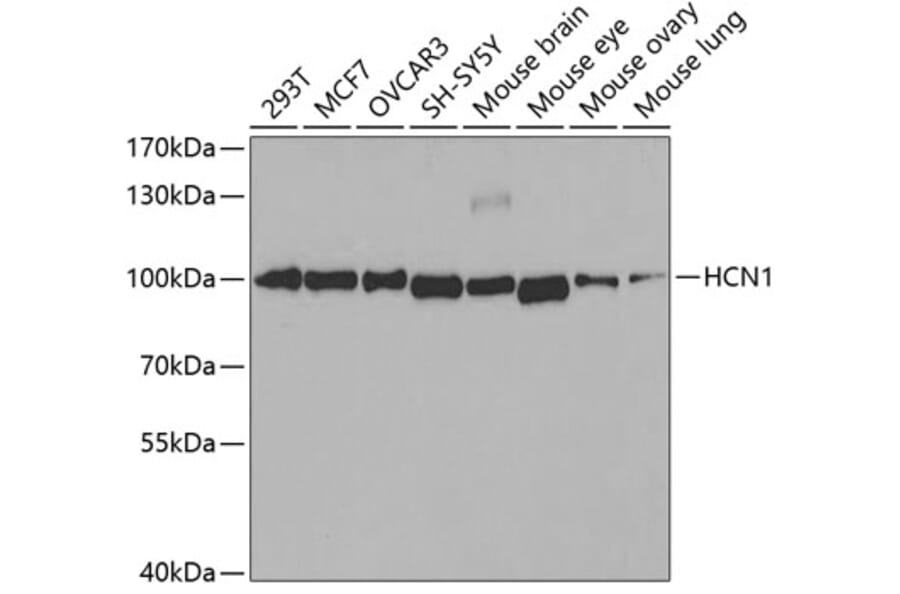 Western Blot - Anti-HCN1 Antibody (A11591) - Antibodies.com