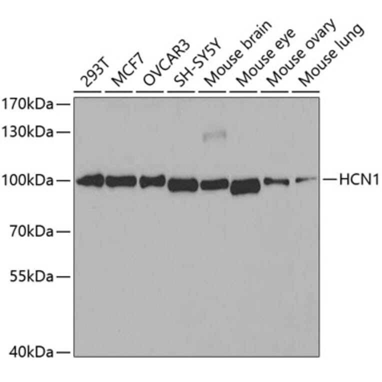 Western Blot - Anti-HCN1 Antibody (A11591) - Antibodies.com