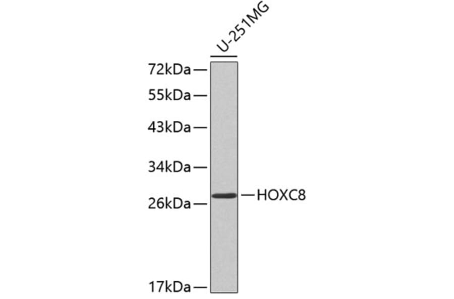 Western Blot - Anti-HOXC8 Antibody (A2975) - Antibodies.com