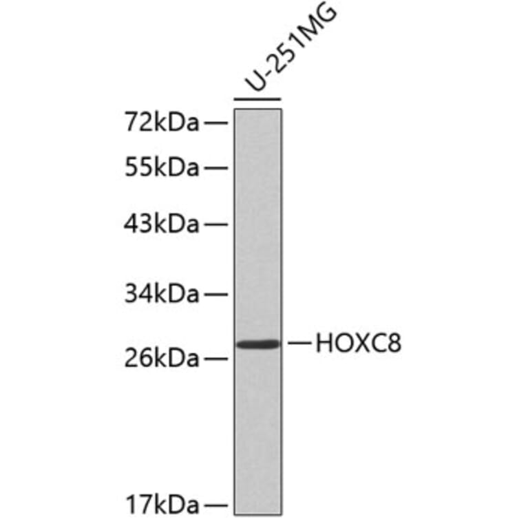 Western Blot - Anti-HOXC8 Antibody (A2975) - Antibodies.com