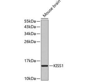 Western Blot - Anti-Kisspeptin Antibody (A11594) - Antibodies.com