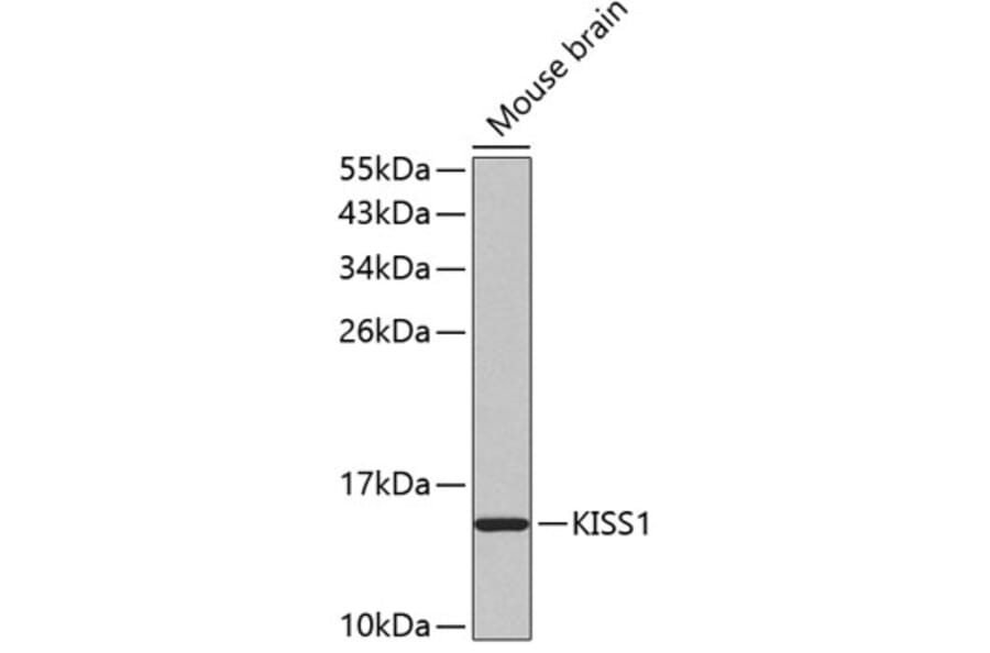 Western Blot - Anti-Kisspeptin Antibody (A11594) - Antibodies.com
