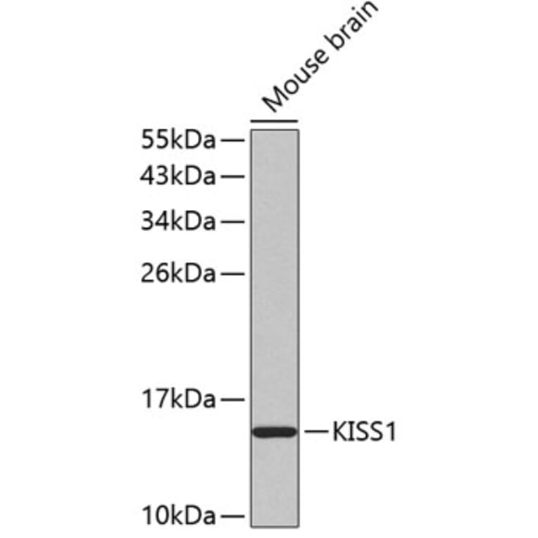 Western Blot - Anti-Kisspeptin Antibody (A11594) - Antibodies.com