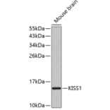 Western Blot - Anti-Kisspeptin Antibody (A11594) - Antibodies.com