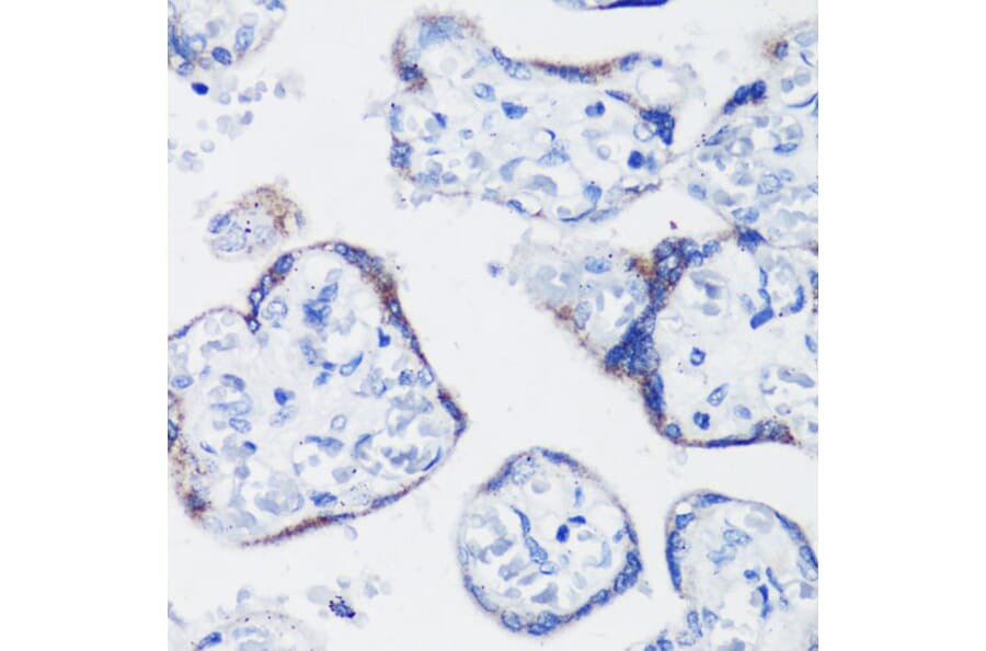 Immunohistochemistry - Anti-Kisspeptin Antibody (A11594) - Antibodies.com