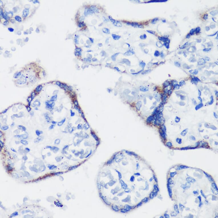 Immunohistochemistry - Anti-Kisspeptin Antibody (A11594) - Antibodies.com