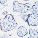 Immunohistochemistry - Anti-Kisspeptin Antibody (A11594) - Antibodies.com