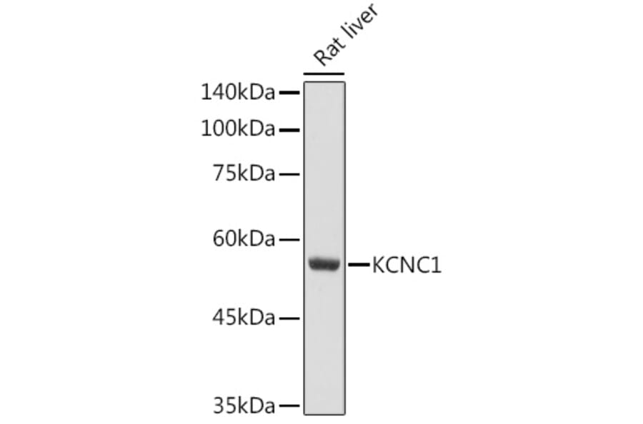 Western Blot - Anti-KCNC1 Antibody (A11595) - Antibodies.com