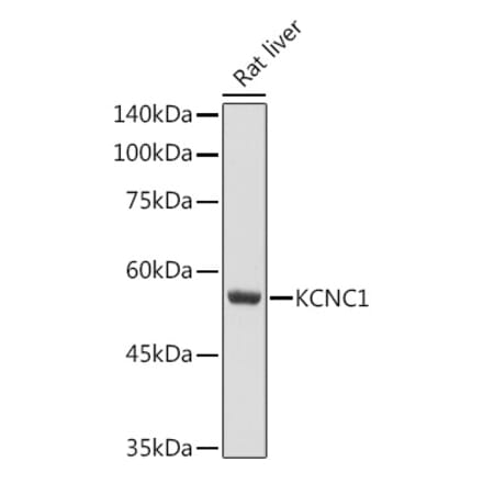 Western Blot - Anti-KCNC1 Antibody (A11595) - Antibodies.com