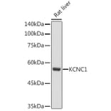 Western Blot - Anti-KCNC1 Antibody (A11595) - Antibodies.com