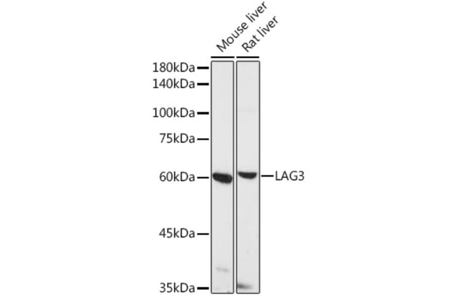 Western Blot - Anti-LAG-3 Antibody (A11596) - Antibodies.com