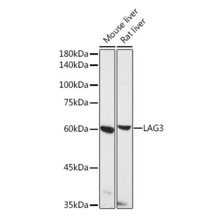Western Blot - Anti-LAG-3 Antibody (A11596) - Antibodies.com