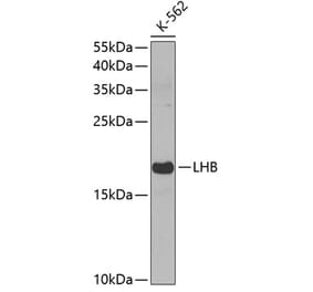 Western Blot - Anti-Luteinizing Hormone beta Antibody (A11597) - Antibodies.com