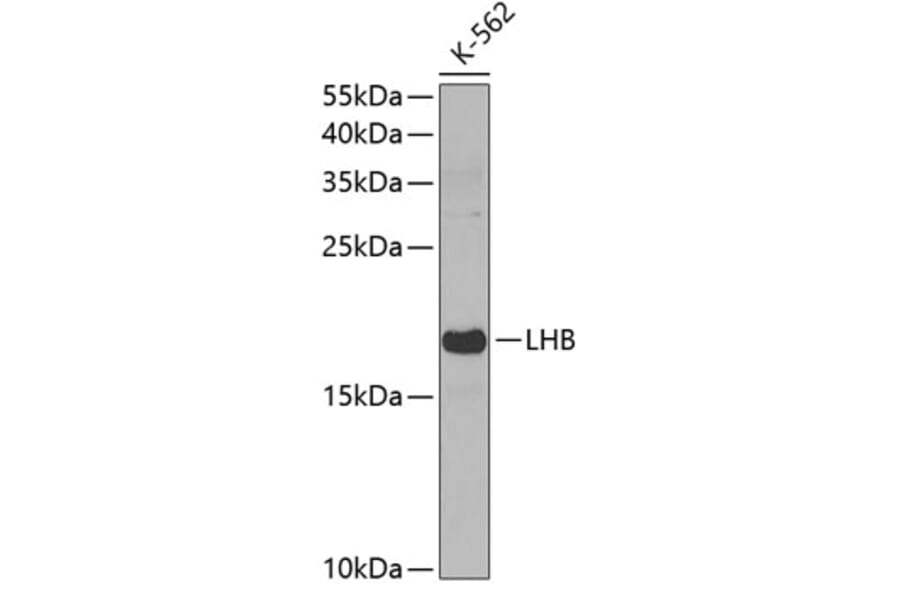Western Blot - Anti-Luteinizing Hormone beta Antibody (A11597) - Antibodies.com