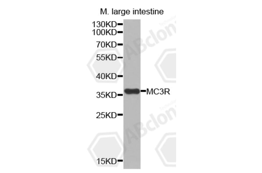 Western Blot - Anti-MC3R Antibody (A3011) - Antibodies.com