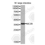 Western Blot - Anti-MC3R Antibody (A3011) - Antibodies.com