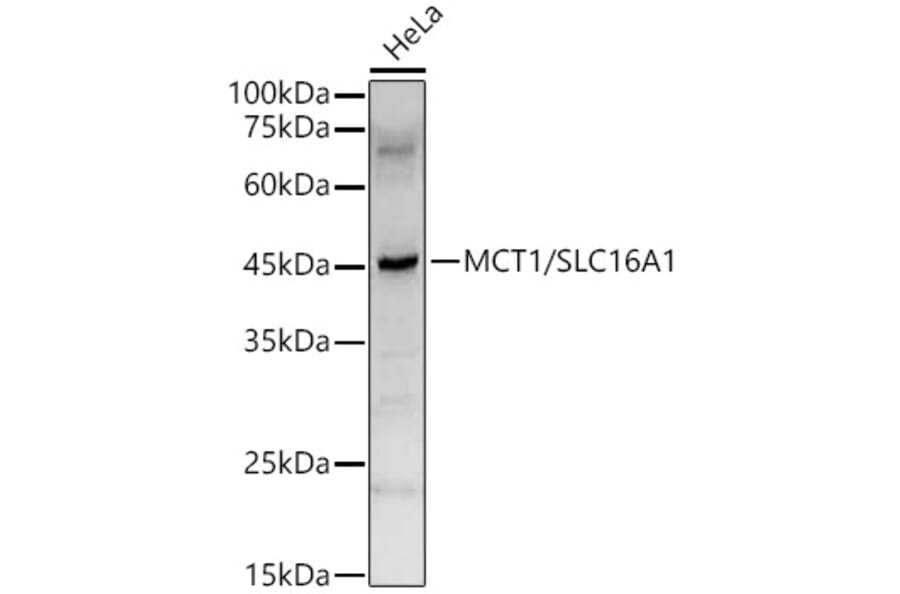Western Blot - Anti-MCT1/Monocarboxylic acid transporter 1 Antibody (A11599) - Antibodies.com
