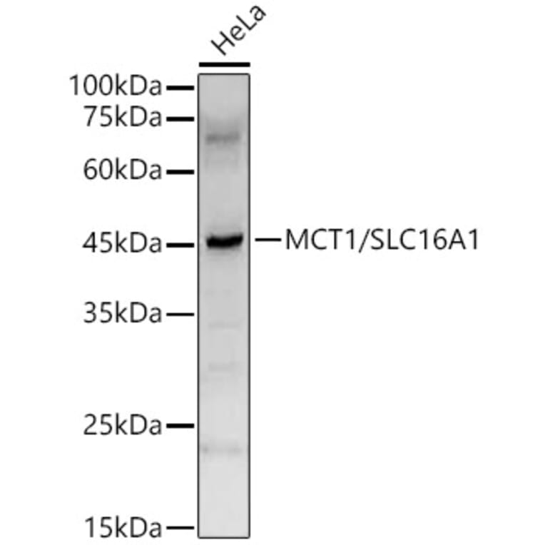 Western Blot - Anti-MCT1/Monocarboxylic acid transporter 1 Antibody (A11599) - Antibodies.com