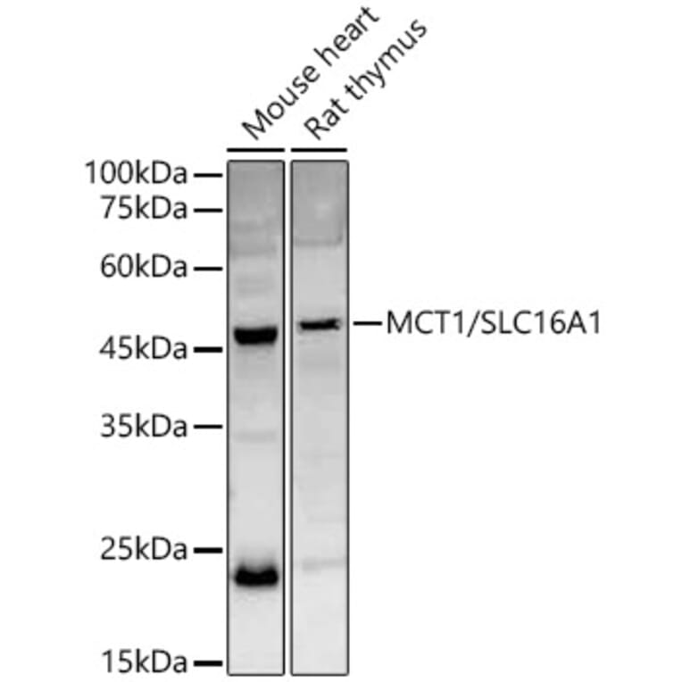 Western Blot - Anti-MCT1/Monocarboxylic acid transporter 1 Antibody (A11599) - Antibodies.com