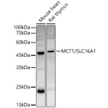 Western Blot - Anti-MCT1/Monocarboxylic acid transporter 1 Antibody (A11599) - Antibodies.com