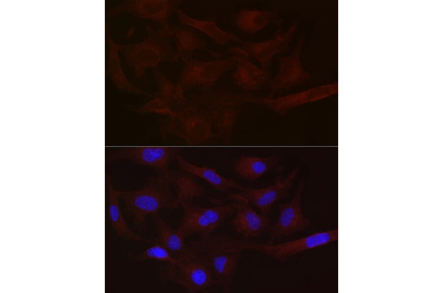 Immunofluorescence - Anti-MCT1/Monocarboxylic acid transporter 1 Antibody (A11599) - Antibodies.com