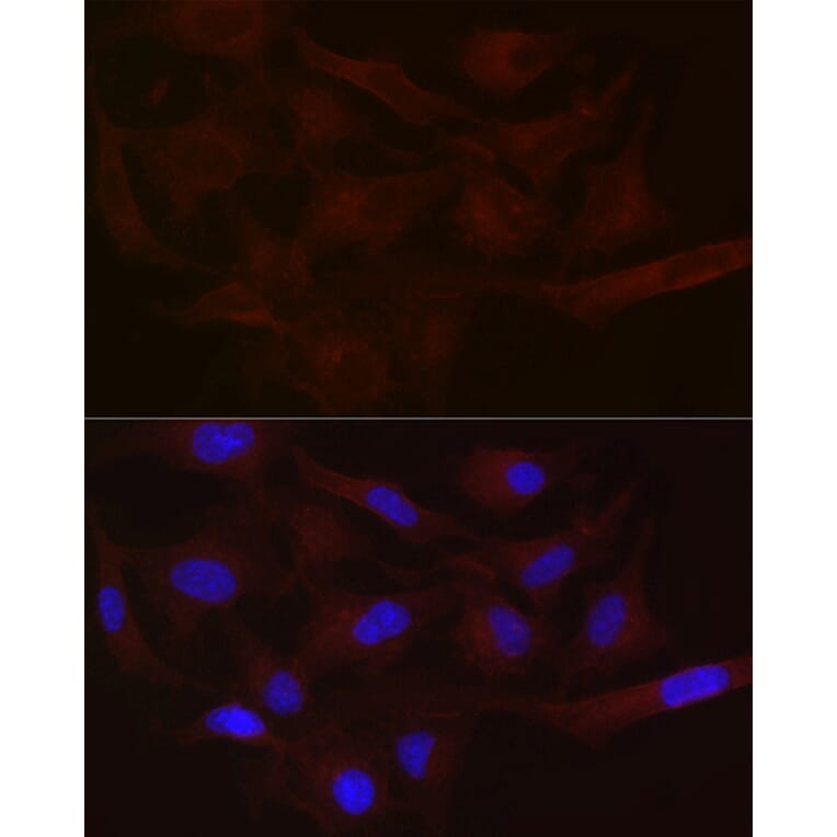 Immunofluorescence - Anti-MCT1/Monocarboxylic acid transporter 1 Antibody (A11599) - Antibodies.com