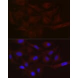 Immunofluorescence - Anti-MCT1/Monocarboxylic acid transporter 1 Antibody (A11599) - Antibodies.com