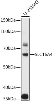 Western blot analysis of extracts of various cell lines, using Anti-SLC16A4 Antibody (A3016) at 1:1,000 dilution.
Secondary antibody: Goat Anti-Rabbit IgG (H+L) (HRP) (AS014) at 1:10,000 dilution.
Lysates / proteins: 25µg per lane.
Blocking buffer: 3% non-fat dry milk in TBST.
Detection: ECL Basic Kit (RM00020).
Exposure time: 60s.