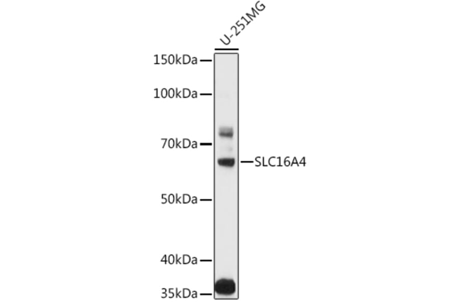 Western Blot - Anti-SLC16A4/MCT 5 Antibody (A11600) - Antibodies.com