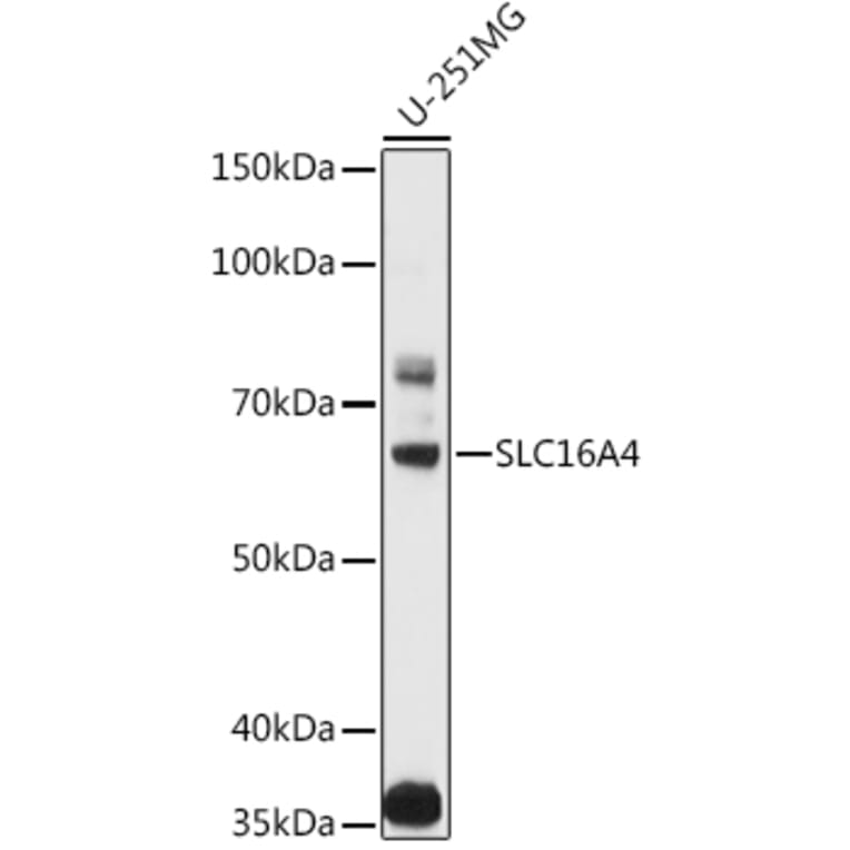 Western Blot - Anti-SLC16A4/MCT 5 Antibody (A11600) - Antibodies.com