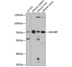 Western Blot - Anti-MCM-BP Antibody (A11601) - Antibodies.com