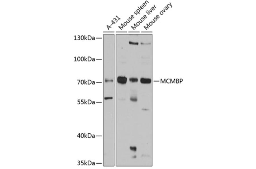 Western Blot - Anti-MCM-BP Antibody (A11601) - Antibodies.com
