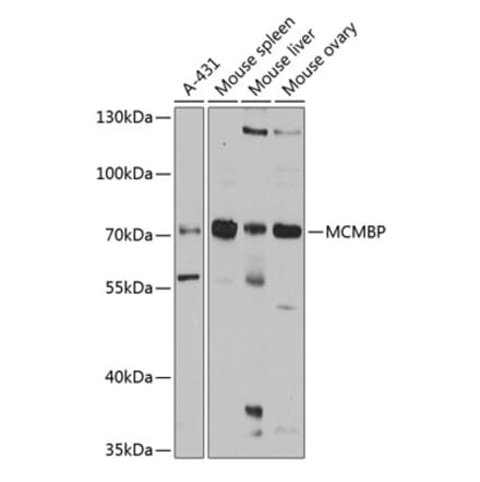 Western Blot - Anti-MCM-BP Antibody (A11601) - Antibodies.com