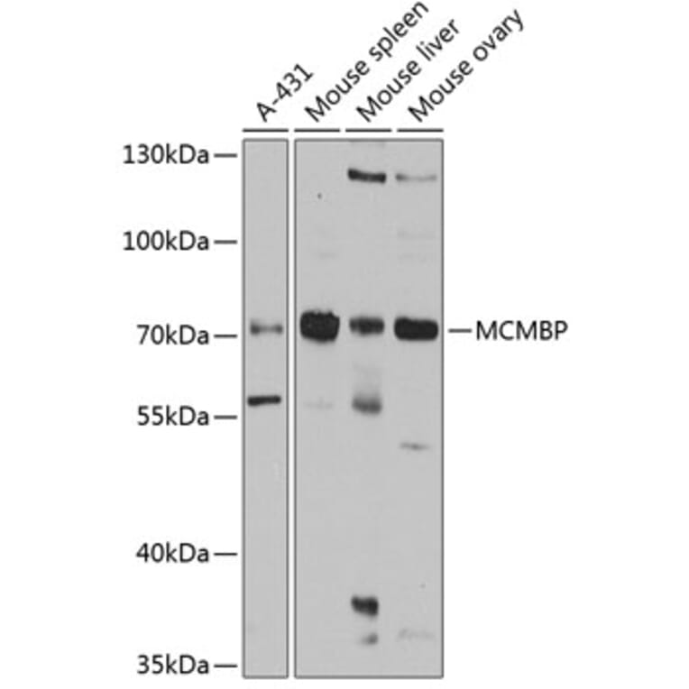 Western Blot - Anti-MCM-BP Antibody (A11601) - Antibodies.com
