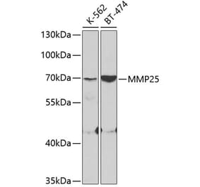 Western Blot - Anti-MMP25 Antibody (A11602) - Antibodies.com