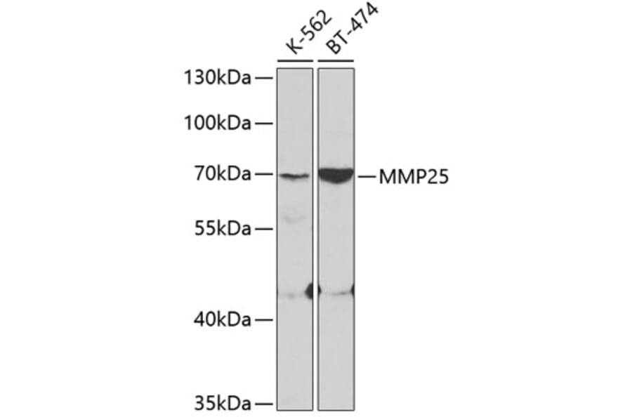 Western Blot - Anti-MMP25 Antibody (A11602) - Antibodies.com