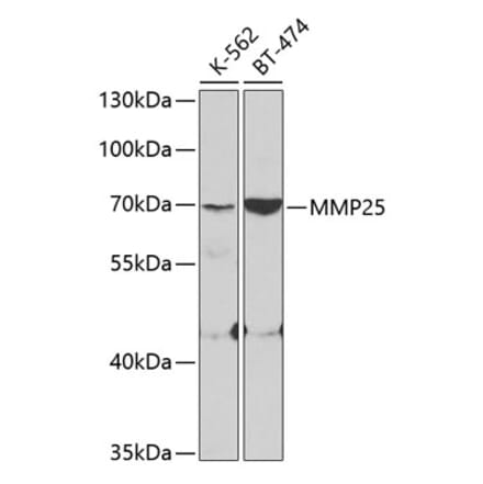 Western Blot - Anti-MMP25 Antibody (A11602) - Antibodies.com