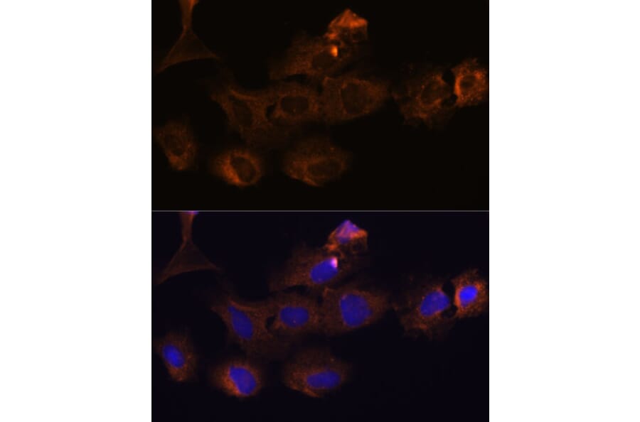 Immunofluorescence - Anti-MMP25 Antibody (A11602) - Antibodies.com
