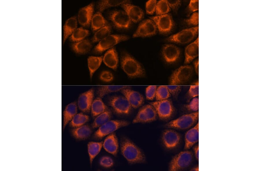 Immunofluorescence - Anti-MMP25 Antibody (A11602) - Antibodies.com