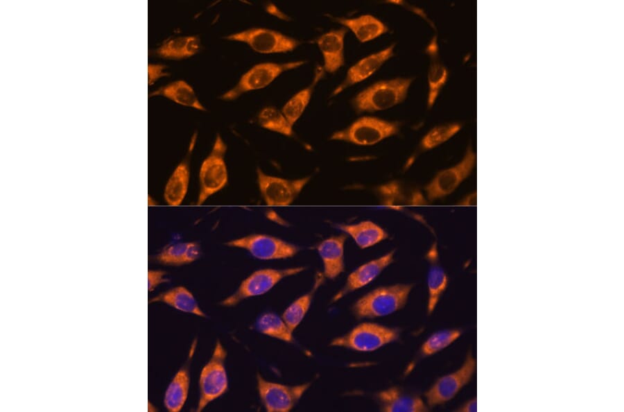 Immunofluorescence - Anti-MMP25 Antibody (A11602) - Antibodies.com