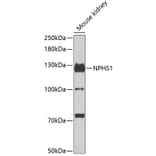 Western Blot - Anti-Nephrin Antibody (A11603) - Antibodies.com