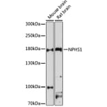 Western Blot - Anti-Nephrin Antibody (A11603) - Antibodies.com