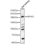 Western Blot - Anti-Nephrin Antibody (A11603) - Antibodies.com