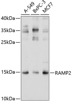 Western blot analysis of extracts of various cell lines, using Anti-RAMP2 Antibody (A3075) at 1:1,000 dilution.
Secondary antibody: Goat Anti-Rabbit IgG (H+L) (HRP) (AS014) at 1:10,000 dilution.
Lysates / proteins: 25µg per lane.
Blocking buffer: 3% non-fat dry milk in TBST.
Detection: ECL Basic Kit (RM00020).
Exposure time: 10s.