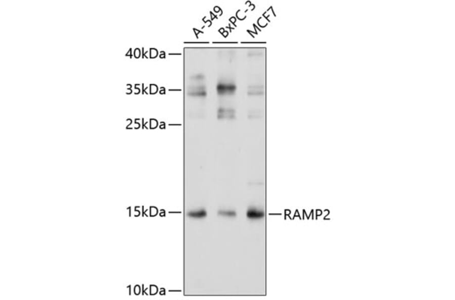 Western Blot - Anti-RAMP2 Antibody (A11605) - Antibodies.com